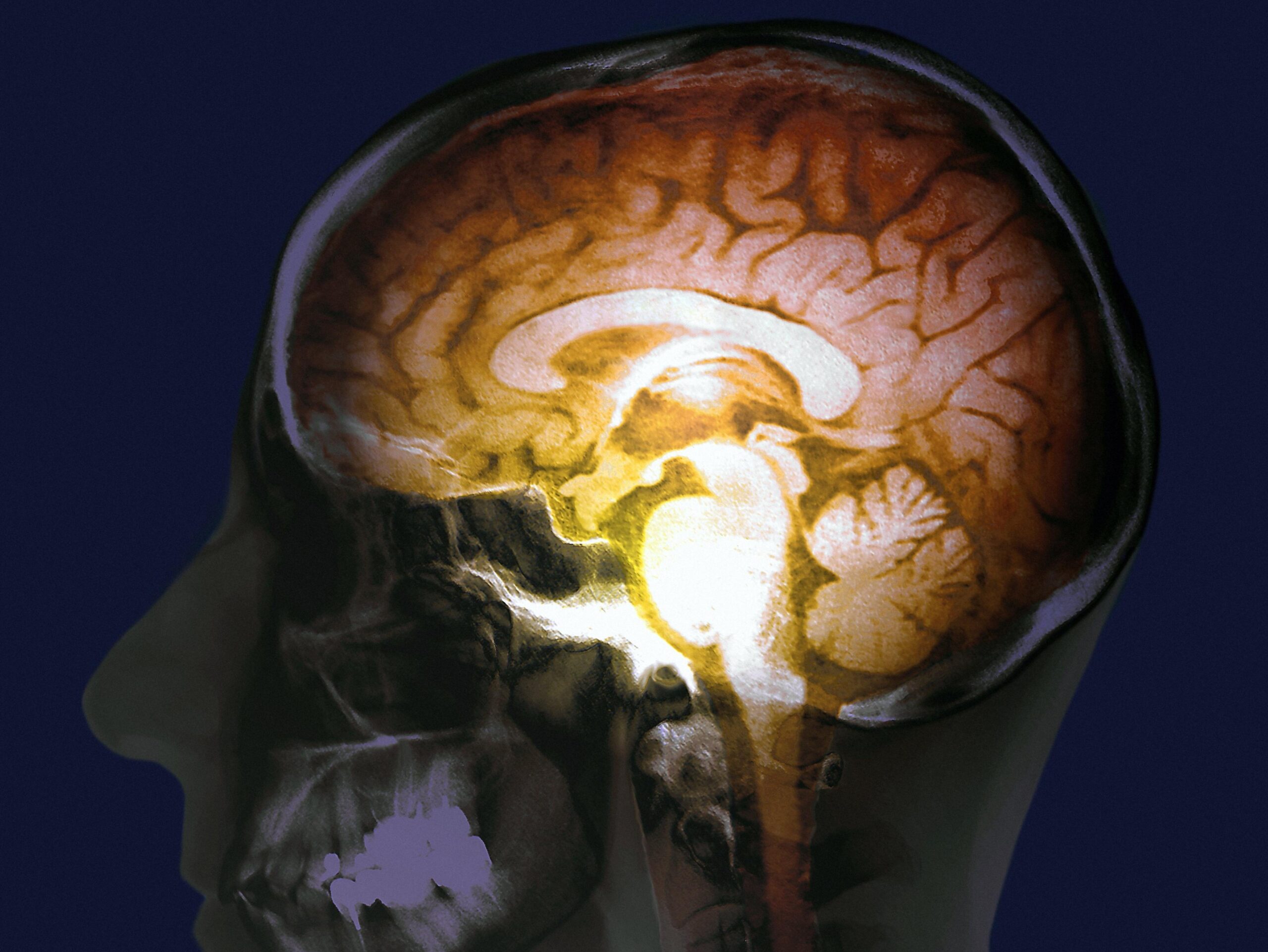 245399960_1538706875 brain activitiy